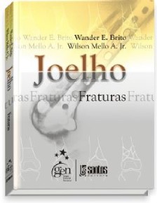 Joelho - Fraturas