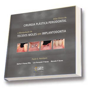 Atlas Clínico De Cirurgia Plástica Periodontal