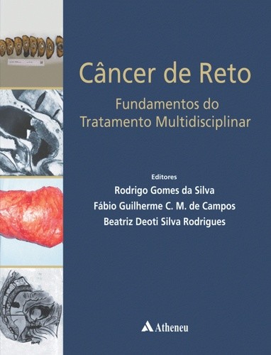 Câncer De Reto - Fundamentos Do Tratamento Multidisciplinar